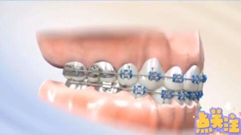 补牙齿视频国产